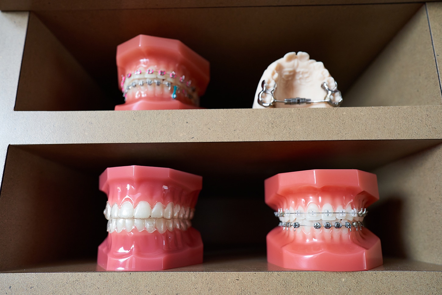 Types of Braces
