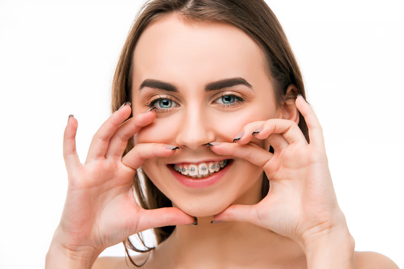 Smiling woman framing her metal braces with her hands