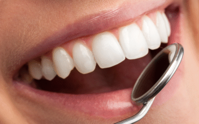 Retainer Troubleshooting: Quick Fixes for Common Issues at Home