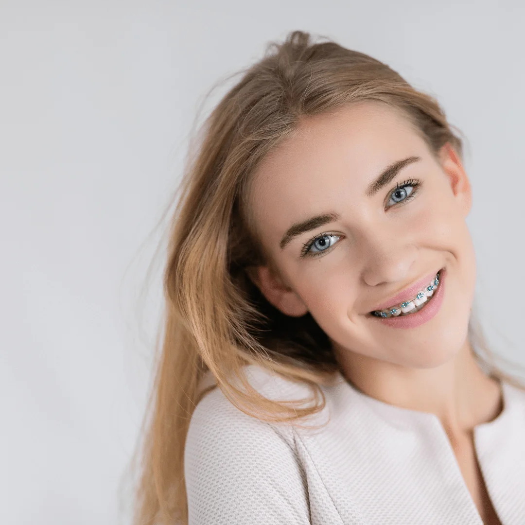 Suresmile Advanced